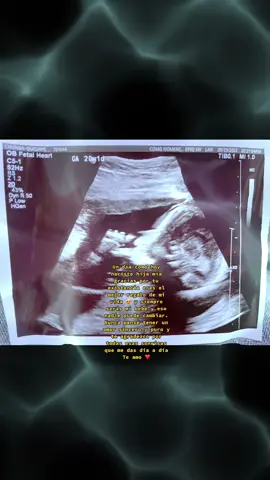 🥹🥹siempre seras mi bebe 😍❤️♥️🥹 #fypシ゚viral #elenaychris #babyaleyna #happybirthday #teamo 