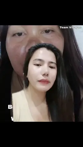 naghahanap ka ba ng produktong pang tanggal ng Pekas melasma pimple and acne marks?   #fyp #foryoupage #trending #viralvideo #pekascream #botoxcream #capadosabeautyproducts 