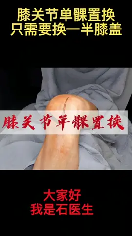 膝關節置換的微創治療！但是要知道不是適合所有人#醫學科普 #健康 #膝關節 
