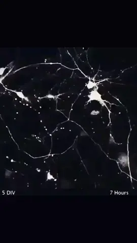 sinapsis neuronal #anatomia #parati #foryoupage #foryou #mistery #asombroso #curiosidades #cuerpo #discovery #fly #latam #fyp 