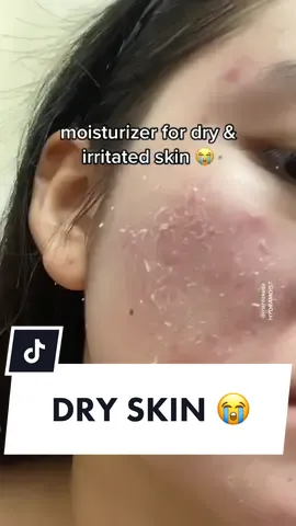 I have super duper sensitive skin!! huhu I'm so happy I found this skincare product 😭 #skincare #skincareroutine #skincaretips #sensitiveskin #clearskin #moisturizer 