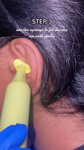 Ear Impressions #satisfying #ears #earmould #earimpressions #mould #satisfying #satisfy #foryou #fyp #satisfyingvideo 