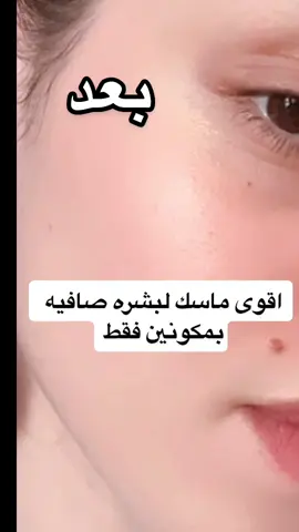 اقوى ماسك لبشره صافيه 🥹  #ماسكات_طبيعية #عناية_بالبشرة  #ماسكات_للوجه  #بشرة_صحية #بشرة_صافية #fyp #4u #explore 