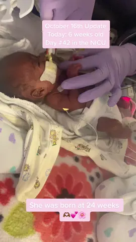 Baby girl is 6 weeks old as of today. Miyanna is doing amazing. Doctors are still focusing on getting her to grow so she can get this breathing tube removed and move to the next oxygen machine that will be in her nose. At this time her nose is still too small. Everything is going okay with her. She mainly rest all day and night in her little bed. Over the past few days she has been keeping on her weight so we just want that to continue. Today Miyanna is 1 pound 10.8 ounces. She loves to sleep during the day and be up all night looking around. 💕🌸🫶🏾💜 i love my new pump better then the momcozy  #fyp #foryoupage #foryou #foryourpage #micropreemiemom #micropreemiestrong #micropreemie #micropreemiereborn #preemie #preemiestrong #preemiemom #preemiebaby #preemiebabies #nicu #nicubaby #nicumom #nicustrong #nicunurse #nicubabies #nicujourney #DidYouYawn 