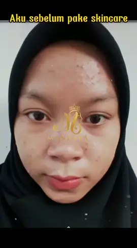 #DidYouYawn #mandelabeautycare #mbcbandung #fyp #flksyaguys🥰biarrame🥰 