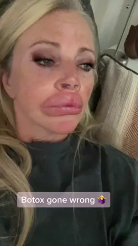#fyp #chelly #oklahoma #classylady #fun #50 #tiktok #foryoupage #foru #silly #lips #puffy #biglips #botox #botoxgonewrong #oops #gorgeous #talent #famous #smile #humor #trend