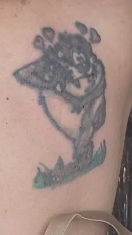 Removendo. tatuagem #tazmania #laser #tatuagem