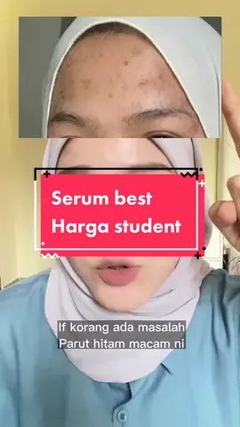 Banyak cara boleh hilangkan parut yang penting jangan putus asa! #tranexamicserum #serummores #racunskincare #skincaremalaysia #fypシ 