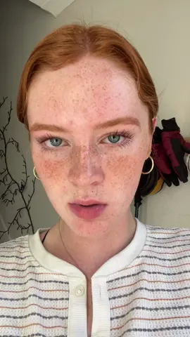 Call me Ms. freckles