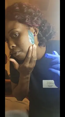 Step 1.. never shave again.... #EstheticianSchool #Student #facewax  #wax #sideburns #pcosawareness #fyp #foryou 