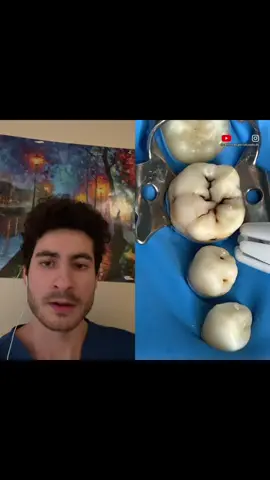 #duet with @centro.especializado.dc Tooth hurry #teeth #explain #doc #dentist #dental #satisfying #comedy #commentary 