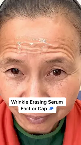 #stitch with @bendr.maoitooy a serum that gets rid of wrinkles 🤔 