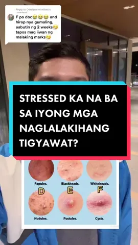 Replying to @Dorayaki ni mikey Stressed ka na ba sa iyong mga naglalakihang tigyawat??? #cysticacnetreatment #LearnOnTikTok #fyp #fypage #fypシ゚viral 