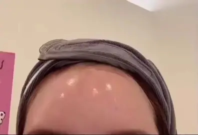 Shiny smoooth forehead 😍 #shinyforehead #smoothforehead #bigforehead #forehead #fyp #viral 