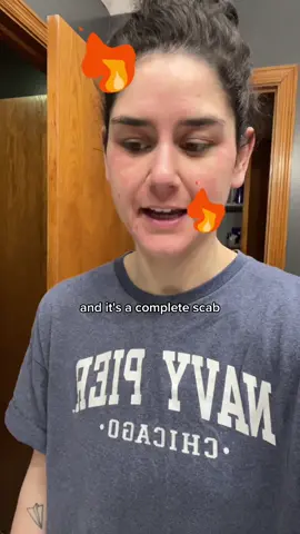 I think I’m convinced my skin doesn’t work like other people’s skin. 🙃 #productstoavoid #skincare 