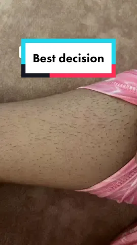 Best decision ever🤌🏻 I did just 4 sessions, I have 4 more sessions. #laserhairemoval #hairy #unwantedhair 