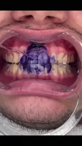 What do you think of this toothpaste?  try?🧐#tiktok #fyp #toothpaste #white #purple #v34 