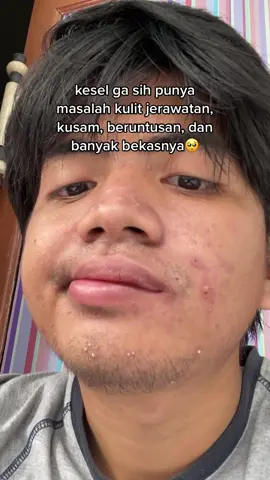 worth it bangettt😍 #mensreaction #cleanserforacneskin #skincarepria @Men's Reaction Official 