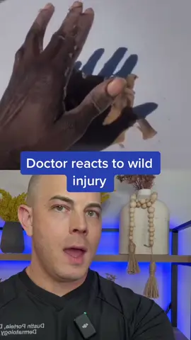#duet with @raytry2times this is bad #doctor #react  