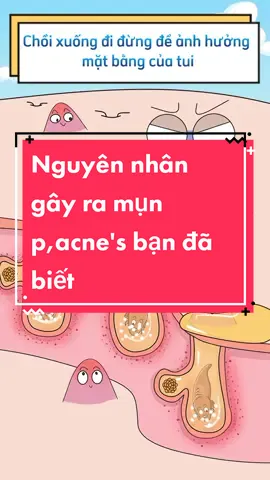 vi khuẩn p,acne's gây ra Mụn như thế nào. #baoboi #mụn24h #xuhuongtiktok #chamsocda #skincare #arms #mụn_đâu_đen #herrin #uocduoclenxuhuong #cogaiaovang #xuhuong2022 #Mun 