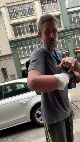 American guy was going to lose his hand #Love #usa 