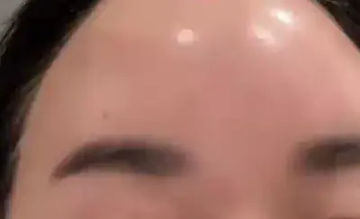 Shiny shiny forehead!