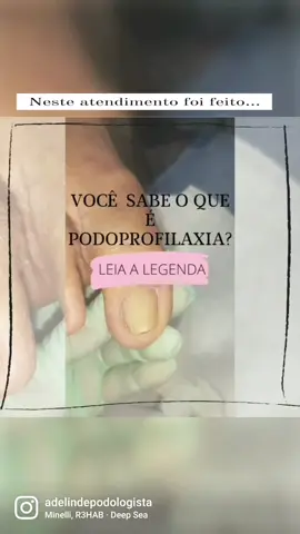 Podoprofilaxia  em pés de idosa. #unhaencravada #podologia  #maringá  #podologiamaringá #adelinde  #podologas #pés #pedicure 