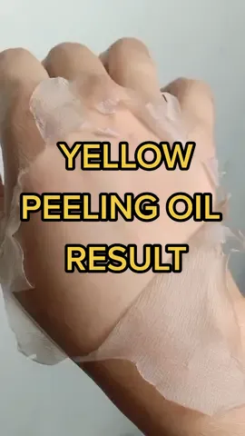 Replying to @clarityessentials.carla naglighten ung peklat ko 🥺 #clarityessentials  #clarityessentialsyellowpeelingoil 