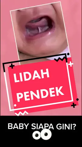 Tongue-tie atau nama lainnya lidah pendek.. #tonguetie #lidahpendek #breastfeeding #penyusuanibu #susuibu #bayi #baby #lidahbaby #lidahbayi #klinikdiyana #klinikdrperempuan #melaka #bukitbaru #tiktokguru 