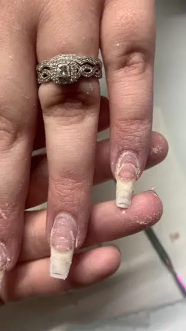 Going to be growing out the damage with overlays. This is just the most terrible thing I’ve ever seen 😭 #nails #nailtech #nailsoftiktok #sanantonionailtech #nailsnailsnails #chopshop #damagednail #damagednailbeds #nailcommunity 