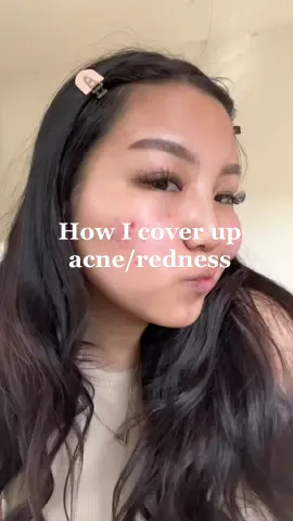 Needless to say-  make up is not needed to cover up & look beautiful! #makeuptransformation #beauty #makeupwithacne #acne 