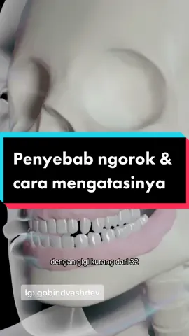 Ada 4 , silakan disimak dan di lakukan untuk mengatasi nya#gobindvashdev ###buteykoindonesia #napas #ngorok #mendengkur 