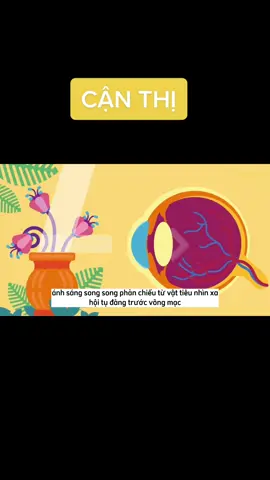 Cận thị là gì? #canthi 