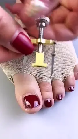 165- Abridor De Espaço Para Unhas Encravadas.  https://shope.ee/6KUK1JfQJs   #shopee #casa #utilidades #saúde #cuidado #dicasuteis #comprasgeniais