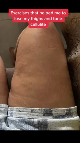 Instagram: Drishti_Sindhi #getfitwithdresty #fyp #foryou #weightloss #fatloss 