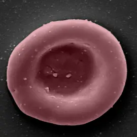 The world's first clinical trial of red blood cells that have been grown in a lab for transfusion into another person. #Medicine #Research #Science