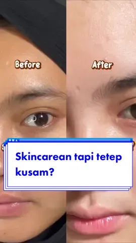 Solusinya #skincareroutine #skincarekulitkusam #cleorabeauty #kusam #solusiwajahkusam #caramenghilangkankusam #caramerawatkulitkusam 