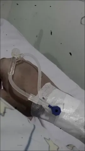 #CapCut Bulan november di awali dengan sakit🥺 terima kasih dan  masih ingat gimana sakitnya dirawat 11 hari di rumah sakit🥺😭 tapi bersyukur banget dapat pelayanan bagus dan perawat nya baik baik #fyp #infus #rumahsakitpontianak 