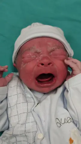 #newbornphotoshoot #newbornvsnowchallenge #newbornbabies #tiktokbabys #newborns #yenidoğan #crybabies #jinekologmuratkayaoglu #jinekologdrmuratkayaoglu #bebekvideo #sezeryandogum #obygn #yenidogan #yenidoganbebek #hamileyimanneyim #bebekler #bebekgeliyor #hamilelikserüveni #normaldoğum #yenidoğanbebek #newbornsoftiktok 