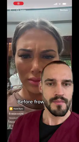 Verlauf nach einer Behandlung mit Botulinumtoxin ☝🏼 #ehrenarzt #beautydoc #schönheitschirurgie 