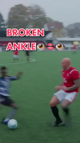 GIVE ME THOSE ANKLES  #worldcup #hospital #sundayleague #football #Soccer #speed #ishowspeed #baiteze #tackle #ankles ##brokenankle #collateral #damage #pokemon 