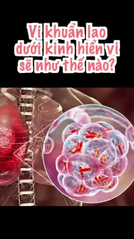 Vi Khuẩn Lao (Mycobacterium tuberculosis) #xetnghiemyhoc #yte #kinhhienvi @Huy Bùi #bentre71🌴🥥 