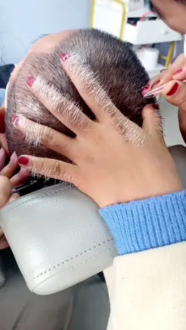 Nhổ tóc bạc, nên hay không nên vẫn cần có 1 cây nhíp chuyên dụng ạ. 