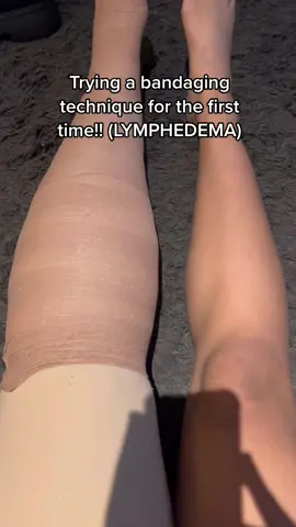 Over the last year and a half the fluid in my calf has really struggled to move, so instead it’s stayed in my leg and hardened up!! This week I found out that my leg is a slight cause for concern and I should act now to try and make my leg softer!! A lovely lady gave me this to try!! It’s from a brand called coban (any tips would be appreciated xoxo) #fyp #viral #trending #uk #lymphedema #primarylymphedema #lymphielife #lymphiestyle #lymphedemaawareness #compression #compressiongarment #bandaging #bandagingtechniques #chroniccondition #chronicpain #disabilitytiktok 