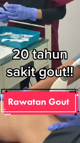 Suntikan sendi untuk sakit gout #fyp #gout #anklepain #painclinic #gouttreatment 