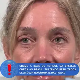 Potente creme anti-idade! Ele é um poderoso agente hidratante e atua na renovação celular. Favorece a produção de colágeno, exerce ação firmadora, umectante e clareadora, auxiliando na melhora da aparência de manchas na pele.😍