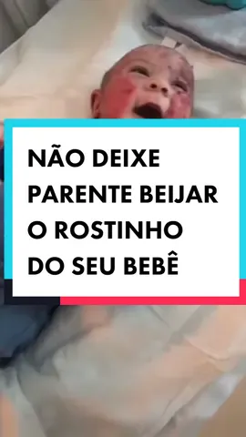 Atenção com as visitas,  oriente os parentes para não beijarem seu bebê!#bebe #doencadepele #herpes #pelesensível  #visitarecemnascido #cuidadoinfantil #mae #pai 