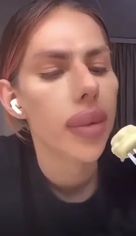 #lips #satire #80sfamousone #sofunnyvideos #funny #biglips #lipfiller #fyppppppppppppppppppppp #baloons #makeup #food #hot #hotfood 