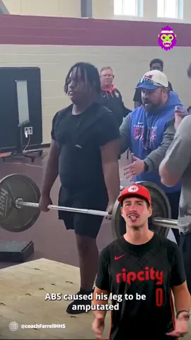 Cason Weatherton was born with one leg but doesn’t let it stop him from absolutely crushing his powerlifting goals and being a major inspiration 💪 @Riley Winn 