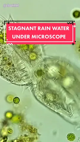 Stagnant Rain Water #undermicroscope #microscopy #microscopic #microcosmos #microworld #microtok #microbiology #cellbiology #🔬 #microscopicview #microscopetiktok 